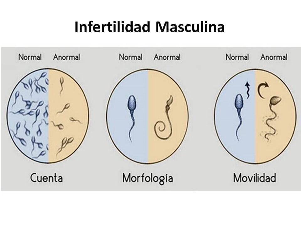 Diapositiva3
