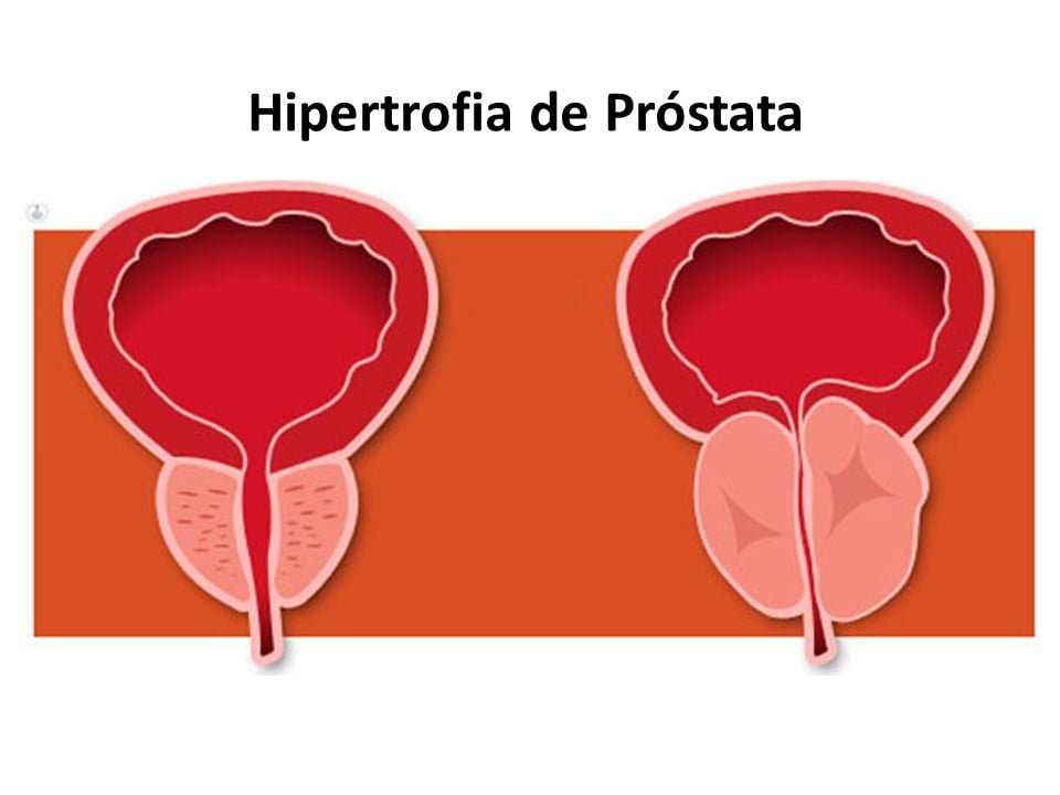 Diapositiva5
